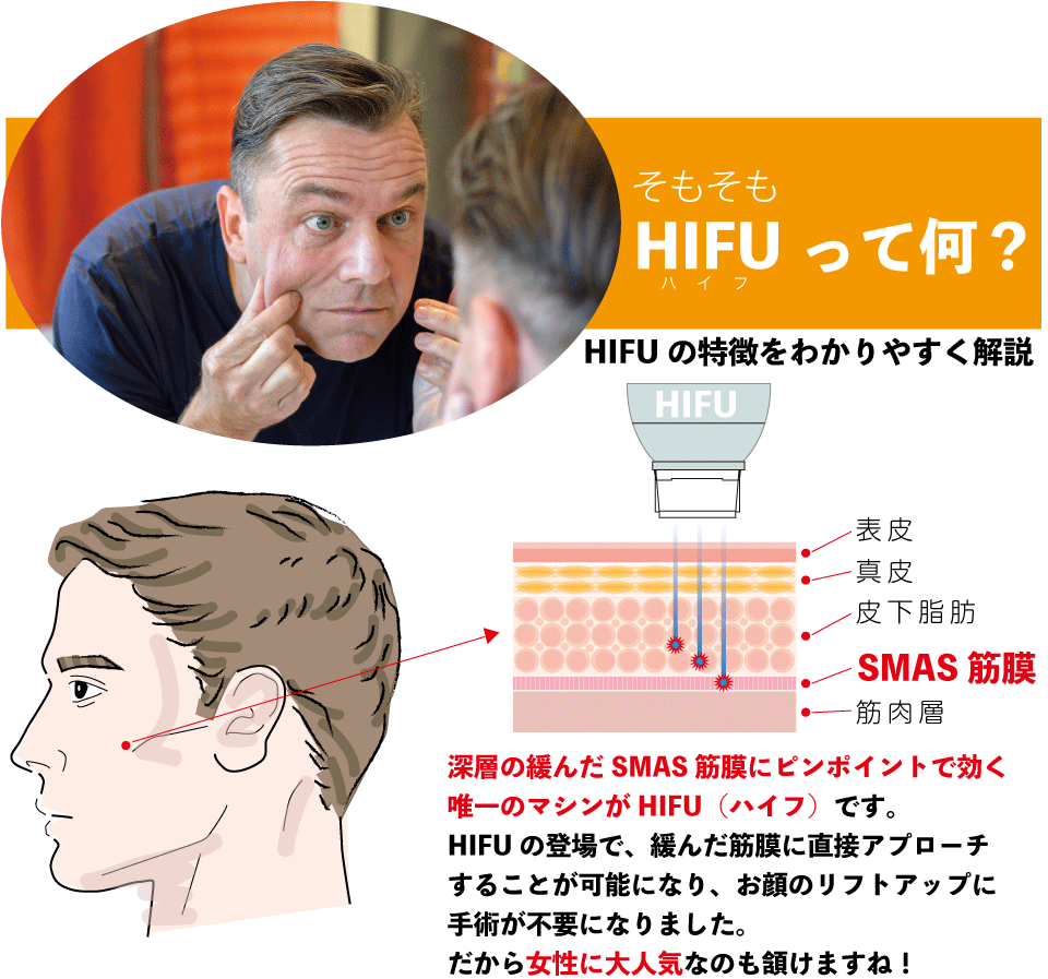 大阪の男性用ハイフのトップ下画像