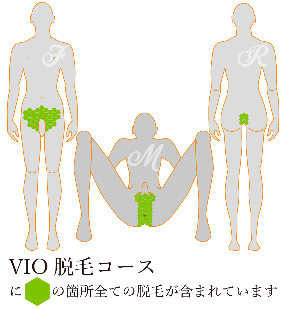 メンズVIO脱毛の脱毛箇所図解